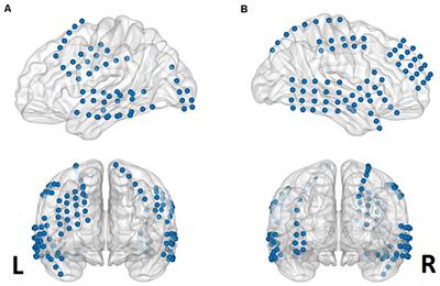 Prediction of Successful Memory Encoding Based on Lateral Temporal Cortical Gamma Power